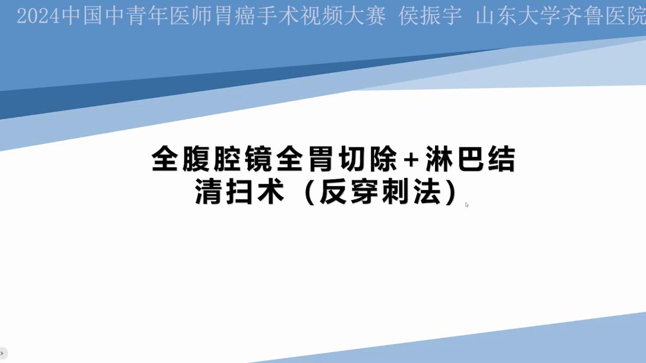 全腹腔镜全胃切除+淋巴结清扫术（反穿刺法）