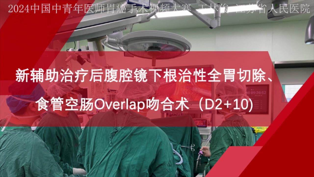 新辅助化疗后腹腔镜下全胃切除+脾门淋巴结清扫