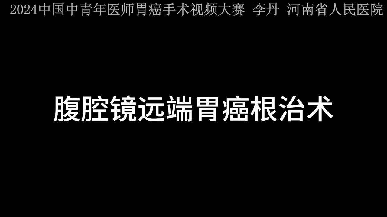 腹腔镜远端胃癌根治术