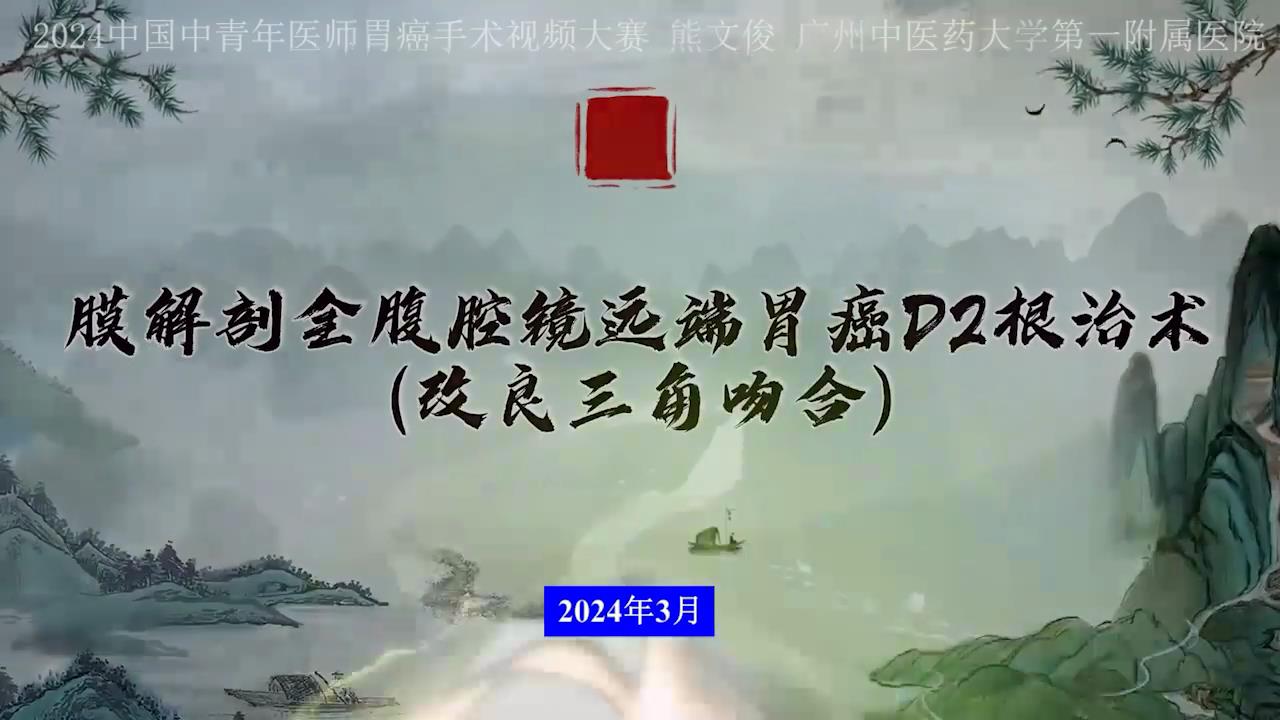膜解剖腹腔镜远端胃癌D2根治术