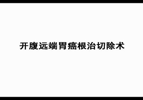 开腹远端胃癌根治切除术