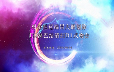 根治性远端胃大部切除术 D2淋巴结清扫Billroth I式吻合