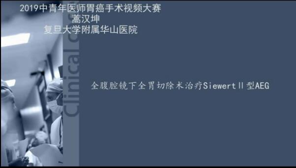 全腹腔镜下全胃切除治疗Siewert Ⅱ型AEG