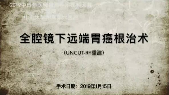 全腹腔镜远端胃癌根治术（Uncut-RY消化道重建）