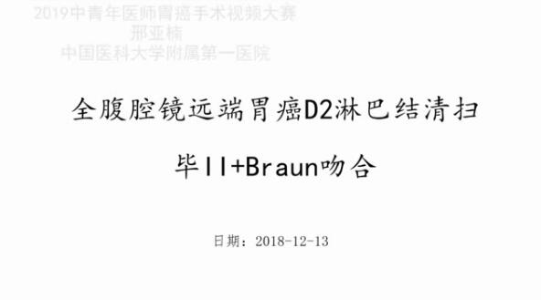 全腹腔镜远端胃癌D2淋巴结清扫毕II＋Braun吻合